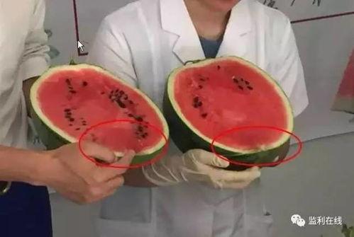 打针后可吃瓜否,能吃瓜吗？揭秘注射后饮食禁忌